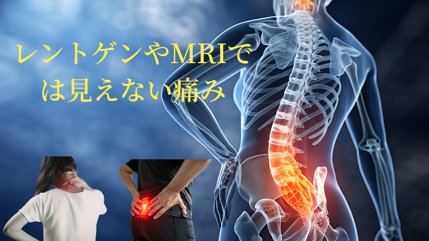 レントゲンによる評価